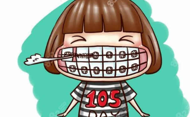 國藥東風(fēng)總醫(yī)院口腔科牙齒矯正怎么樣?貴不貴