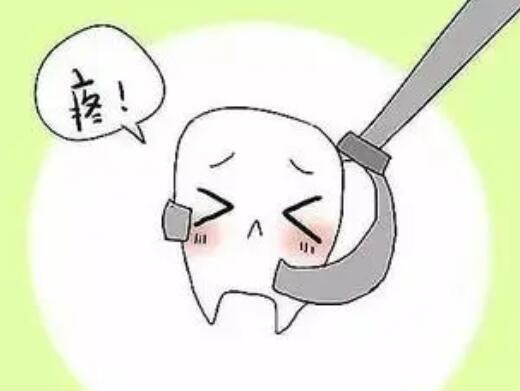 拔牙圖片