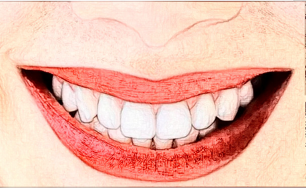 渭南市第一醫(yī)院口腔科牙齒矯正費(fèi)用多少+真人術(shù)后點(diǎn)評(píng)