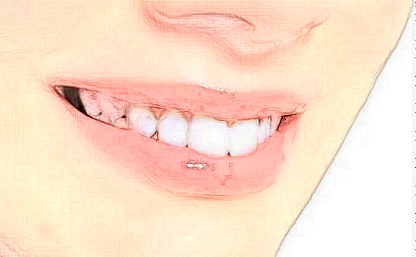 德州市德城區(qū)中醫(yī)醫(yī)院口腔科種植牙技術(shù)專業(yè)嗎+真實(shí)案例在這