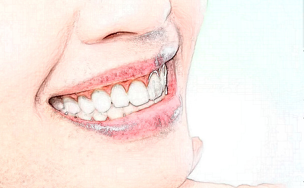 成都中醫(yī)藥大學附屬醫(yī)院口腔科補牙費用多少+真人術(shù)后點評